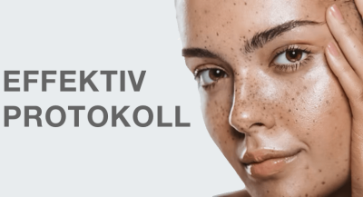 Pigmentering - effektiv protokoll 