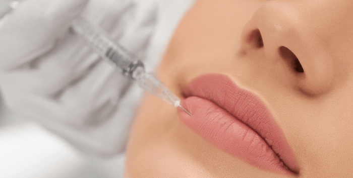 Leppe filler behandling