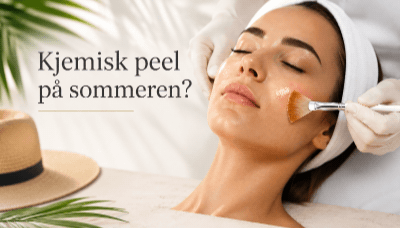 Kjemisk peel p� sommeren?