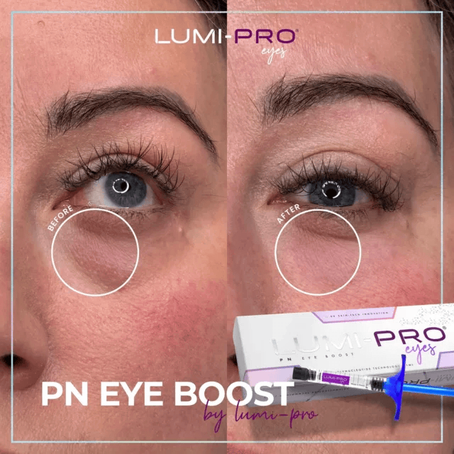 LUMI-Pro  Eyes PN Eye (1x1ml)